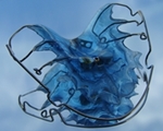 ortho-device-removable-orthodontic-device